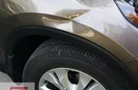 Boyasız Göçük Düzeltme Nedir?